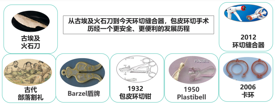 "全球范围内公认最精通、技术含量最高的专业割包皮医生：独家揭秘他的诊疗之道与秘诀"