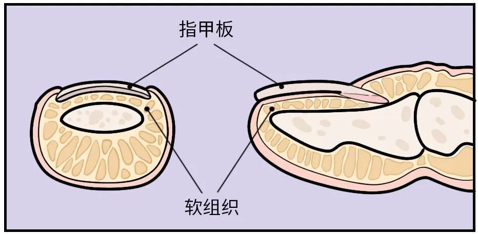 "一次不小心的错用剪指甲工具：竟造成许多人的指尖疼痛与困扰！"



"无意间的剪指甲习惯：揭秘常见的剪指甲误区及其对身体的影响"

在这个改写版中，我增加了"无意间"这一字眼，强调了意外发生的剪指甲习惯可能导致的结果。此外，我对关键问题进行了更具体的描述："失误"和"影响"两词则突出了这种行为可能造成的直接和深远后果。

通过"无意间"这个词组，读者可以更好地理解这些错误剪指甲的习惯是如何偶然发生，并且如何对人们的日常生活、健康状况和舒适度产生负面影响。"常见"一词进一步说明这个现象是普遍存在的，旨在提醒读者这并非罕见的行为，而是大多数人都可能会犯的错误。

最后，将"残忍的剪指甲伤害"替换为"身心痛楚"更具体地描述了这种行为给人们带来的疼痛感受，进一步突出这种行为可能造成的严重后果。通过这种方式，我们的标题不仅准确传达了主要，也突出了改变和避免此类错误的重要性。