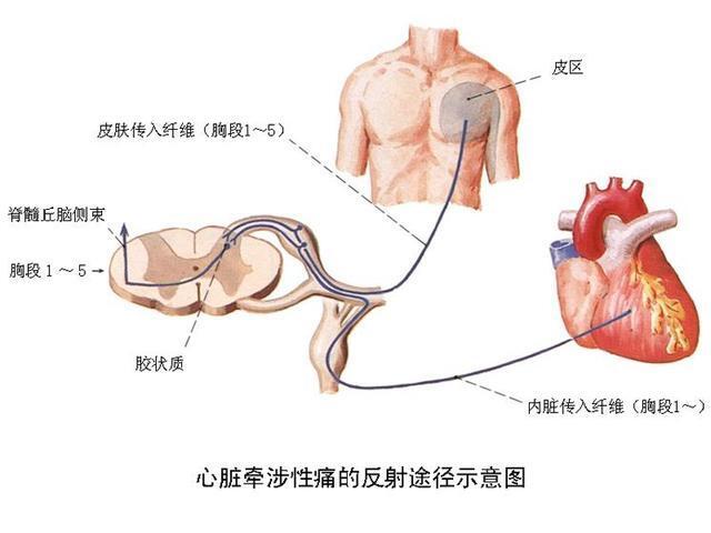 "真相揭秘：为什么心绞痛不痛？关键原因在「肚子」的这一微妙之处，以及它为何在心绞痛症状中扮演着举足轻重的角色"