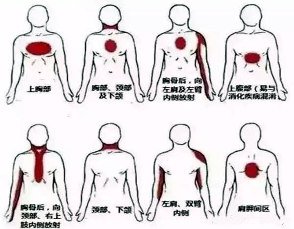 "真相揭秘：为什么心绞痛不痛？关键原因在「肚子」的这一微妙之处，以及它为何在心绞痛症状中扮演着举足轻重的角色"