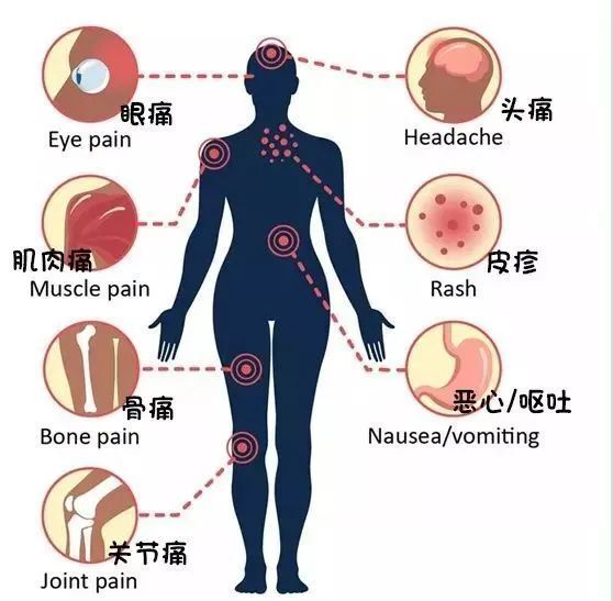 "全球累计确诊逾百万，超千万人感染威胁生命，大规模突感高热须警惕疫情最新动态与应对策略"