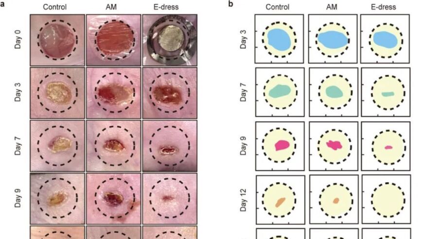 北航常凌乾团队打造绿色科技革新：全新电子衣引领伤口愈合速度的革命性提升