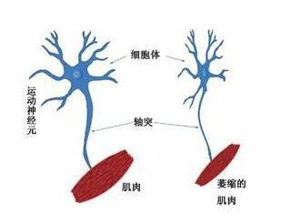 "蔡磊：病魔缠身，尝试各种药物治疗仍未止住渐冻症的进展"