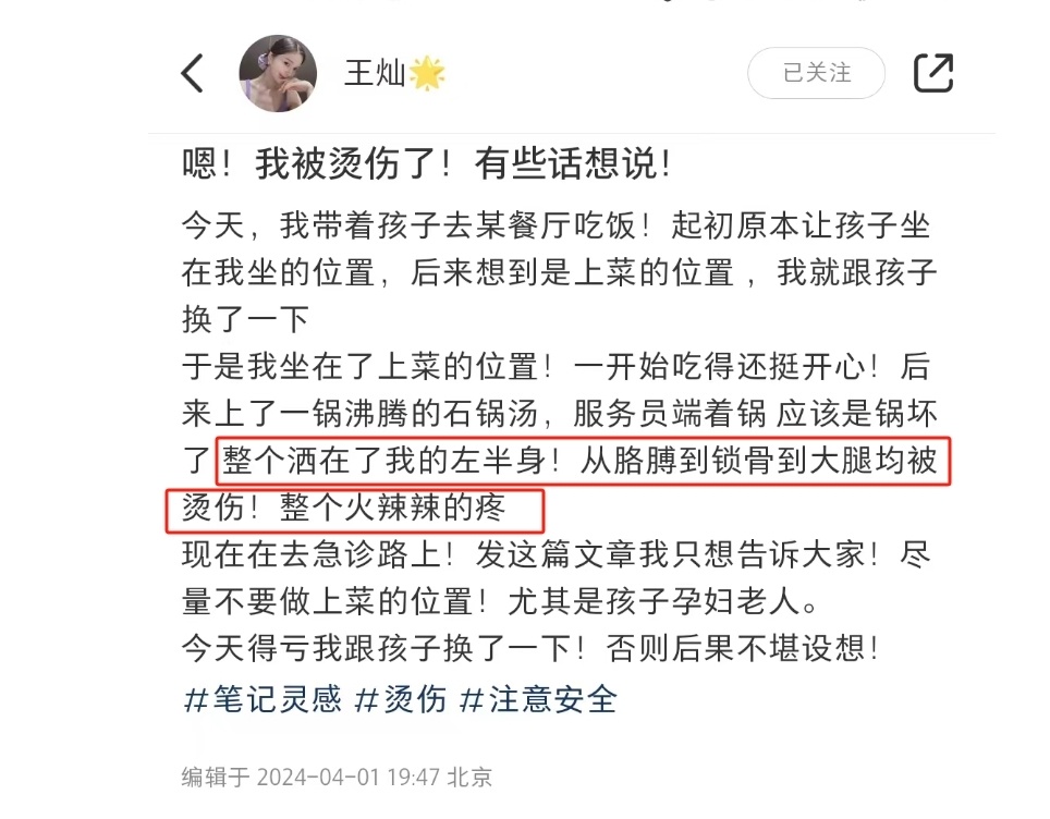 "杜淳老婆女儿就餐时不慎烫伤全身，幸亏及时换位成功"