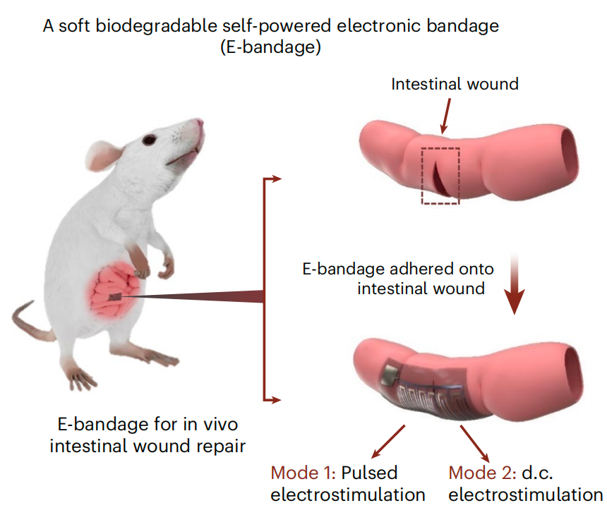 "Nature子刊：创新研发新型电子绷带，提升肠道伤口愈合效果"