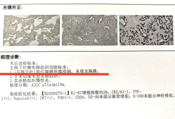 "肺结节的‘侦查器’，精准检测，科学解读！"