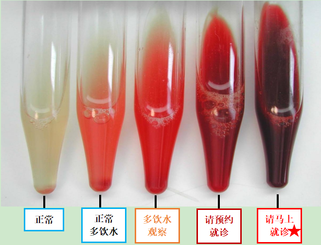 "细致入微的泌尿外科管道护理知识，您的医疗导航专家"