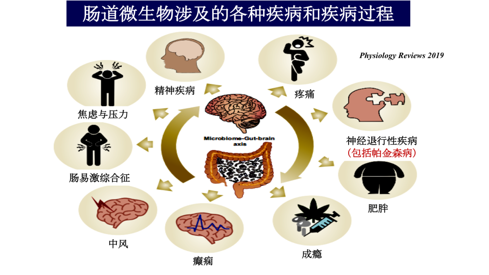 "帕金森病并非唯一神经性脑疾病的早期预警标志，肠胃功能紊乱可能引发该病症。"