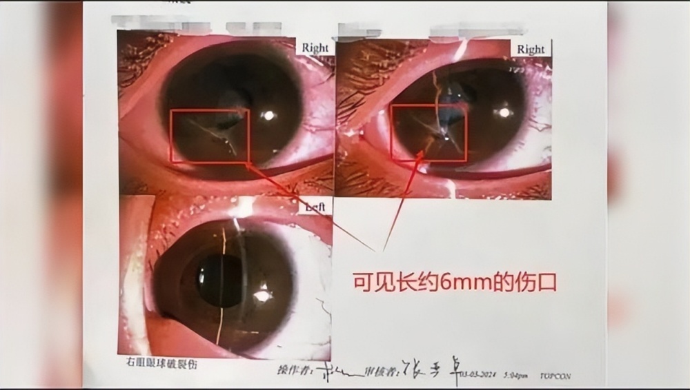 "校园霸凌不是威胁，真实家庭的黑暗面：一个10岁男孩的故事"