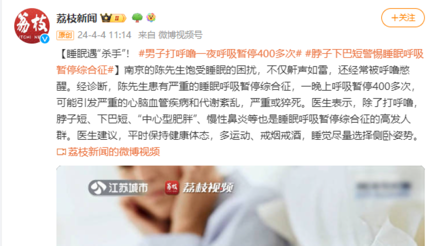 男子打呼噜致一夜呼吸暂停，脖子下巴缩短警惕睡眠呼吸暂停综合征