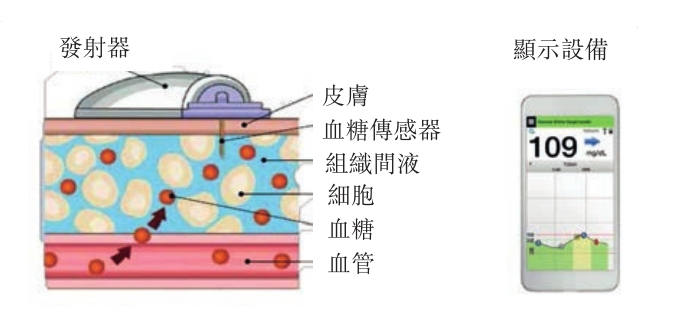 "国产品牌迎新机：血糖监测仪革新大变革，精准数据与智能操控全都在这一步"