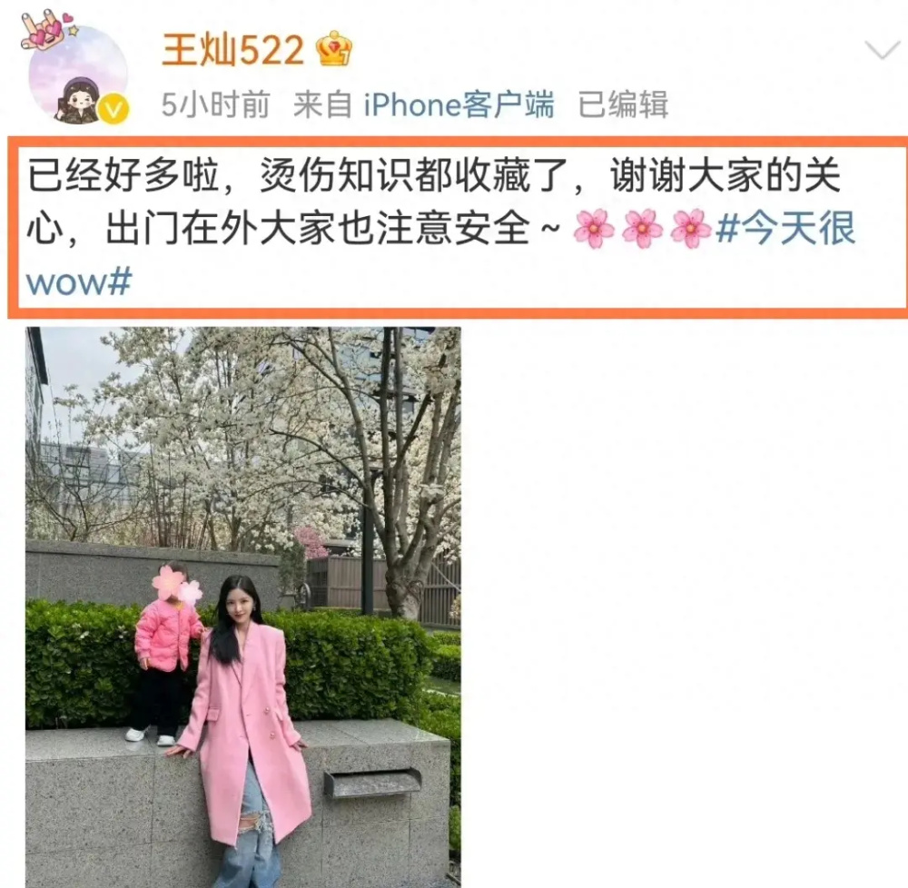 "杜淳妻子初见暂露面：怀抱女儿美美显柔情，透露水泡尚未消退"