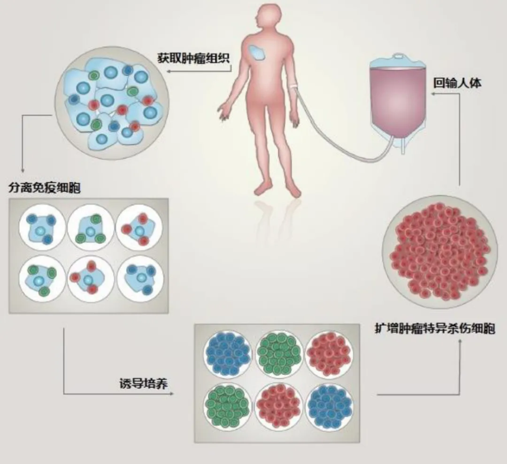 "令人震惊的消息：只需花费400万美元，即可彻底治愈晚期癌症？真相是怎样的呢？"