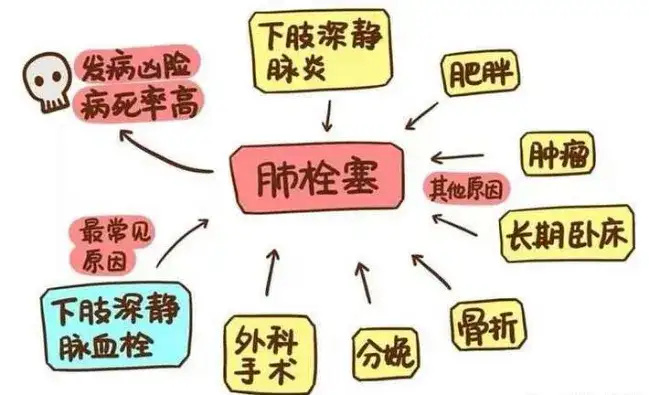 "南京一男子床上支小桌子办公一夜猝死，警惕肺栓塞风险！"