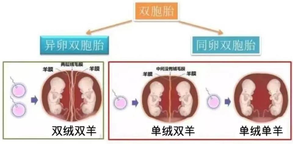 "240天的精心守护，单绒三羊三胞胎成功在湘雅平安降临"

这个标题突出了整个故事的时间跨度和事件的重要性。"240天健康护航"强调了时间的跨度和行动的效果，而"单绒三羊三胞胎在湘雅平安出生"则进一步明确了主题——他们平安出生的事实。两个部分互相补充，形成一个完整、有力的标题。