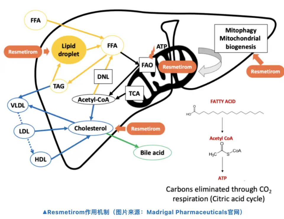 "《脂肝靶向药》在美国 FDA 准备进行批准！脂肪肝诊治将迎来空前热潮"