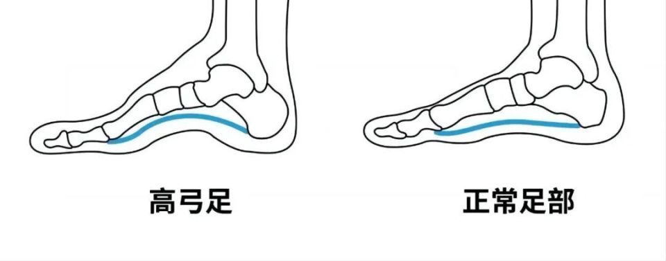 "矫正不良体态：如何让孩子避免这些问题？"