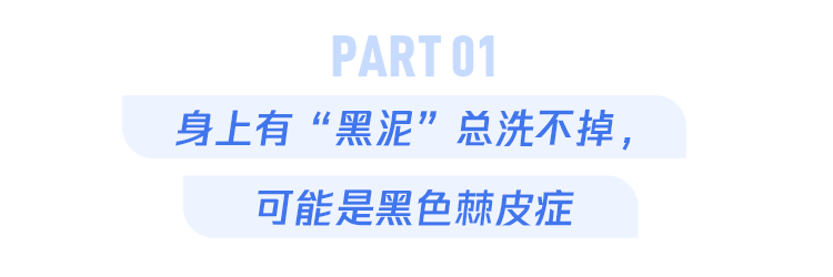 "警惕颈部「黑色褶子」的存在，这4个特征不容忽视！"