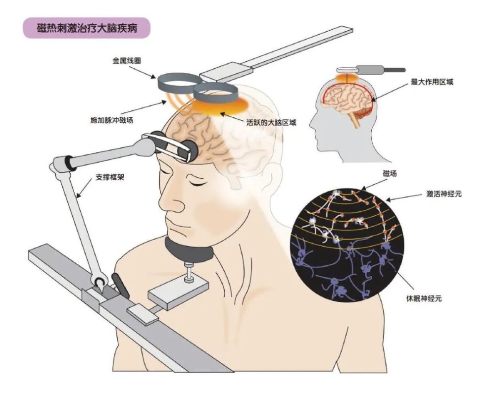 "给你脑壳换一个开关，你会如何操控人心?"