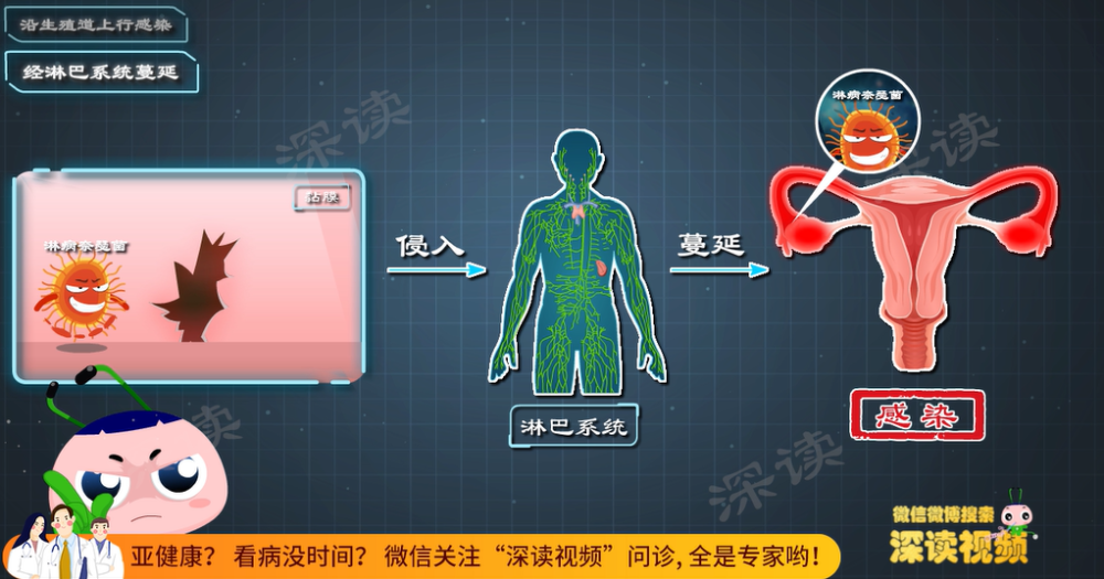 "4大事项助你防止卵巢炎，健康生活从有效管理妇科疾病开始！"