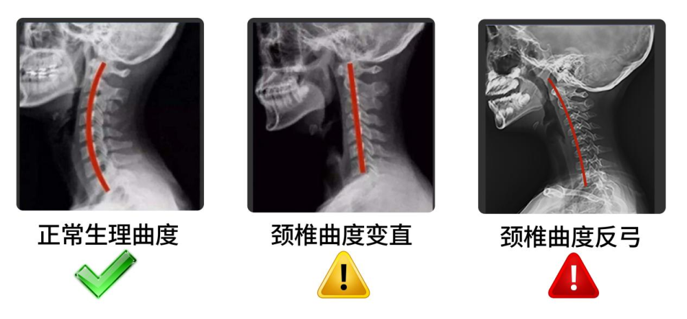 "颈部不适，试试这3个小妙招！有效缓解您的脖子酸痛问题"