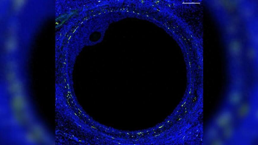 科学家认为：人类首个卵巢图谱可能打开生育新篇章