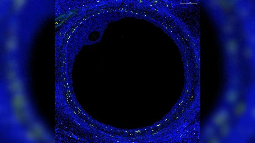 "科学家认为：人类首个卵巢图谱可能打开生育新篇章"