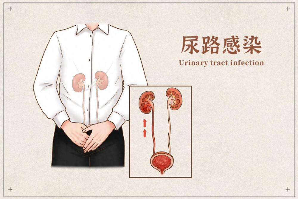"深入了解尿路感染：警惕九种常见病因并做好预防措施"
