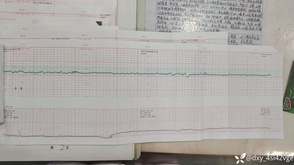 "胎儿多胞胎彩超发现新发胎盘血池：关乎是否需要终止妊娠的问题"