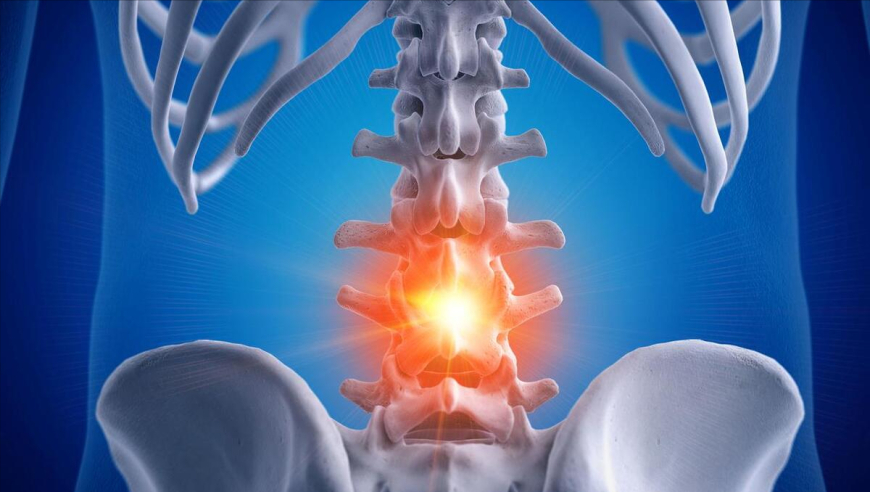 全面解析：从快速发展到截瘫的腰痛——‘腰椎间盘突出’真的就是这样吗?