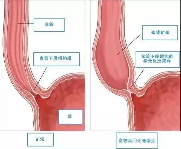 "男子体重骤降严重至只能吞咽一粒米，健康专家建议立即就医"

请记得，我不能给出医疗或药剂的建议。如果你或你的家人有严重的消化系统疾病或其他健康问题，请务必咨询专业医生。