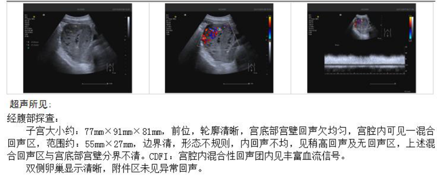 "月子中意外大量出血：只因一碗大补汤？"