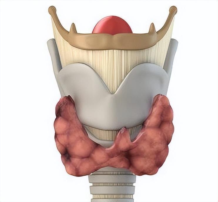 "警惕咽喉不适、咳嗽或吞咽困难！警惕可能的甲状腺结节！"