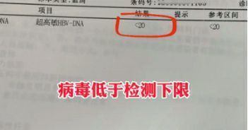 "检测结果显示：你的乙肝病毒量低于这个数值，无需担心肝病！"