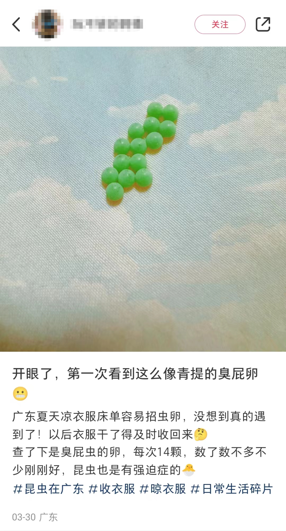 "头屑遍地！南方人近期流行发痒症状，量多到令人担忧？"