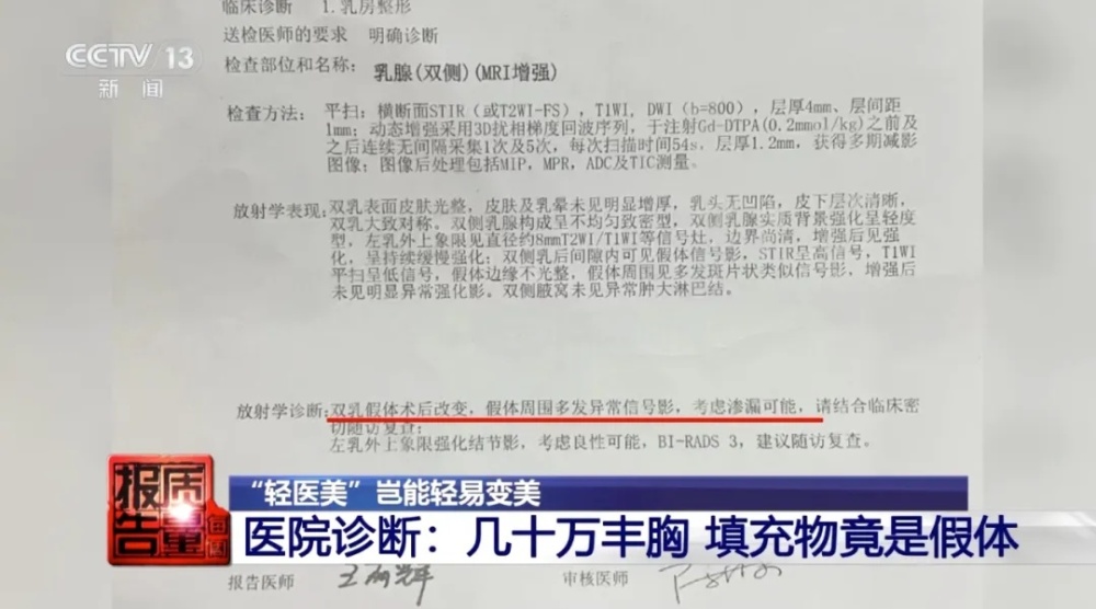 "惊世骇俗！五十万自体隆胸手术后发现注入物中检测出骆驼、蝙蝠与黑猩猩蛋白"