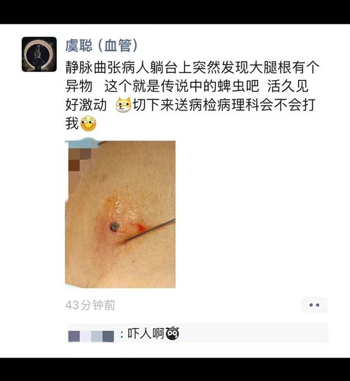 "奇迹般的一幕：外科医生手术中巧妙捕捉并消灭令人头痛的害虫"