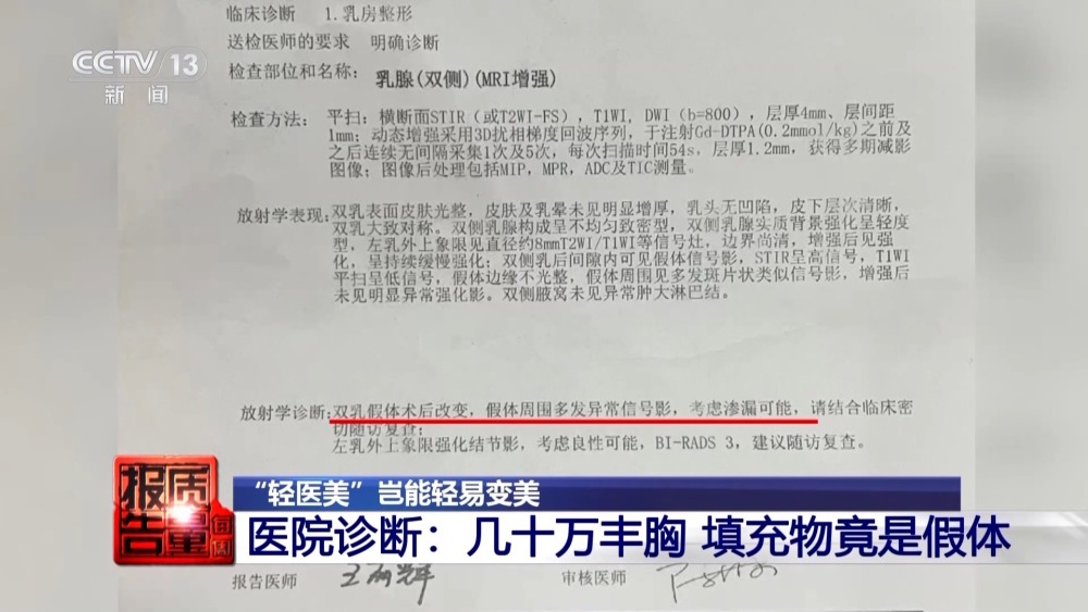 "昂贵隆胸手术揭露真相：费用超过百万元的乳腺填充物检测出多种哺乳动物成分"