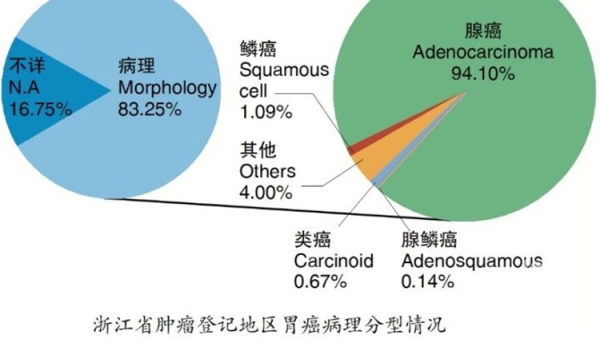 杭州女子胃部不适，医生却揭示她与许多年轻人的生活写照有关的习惯