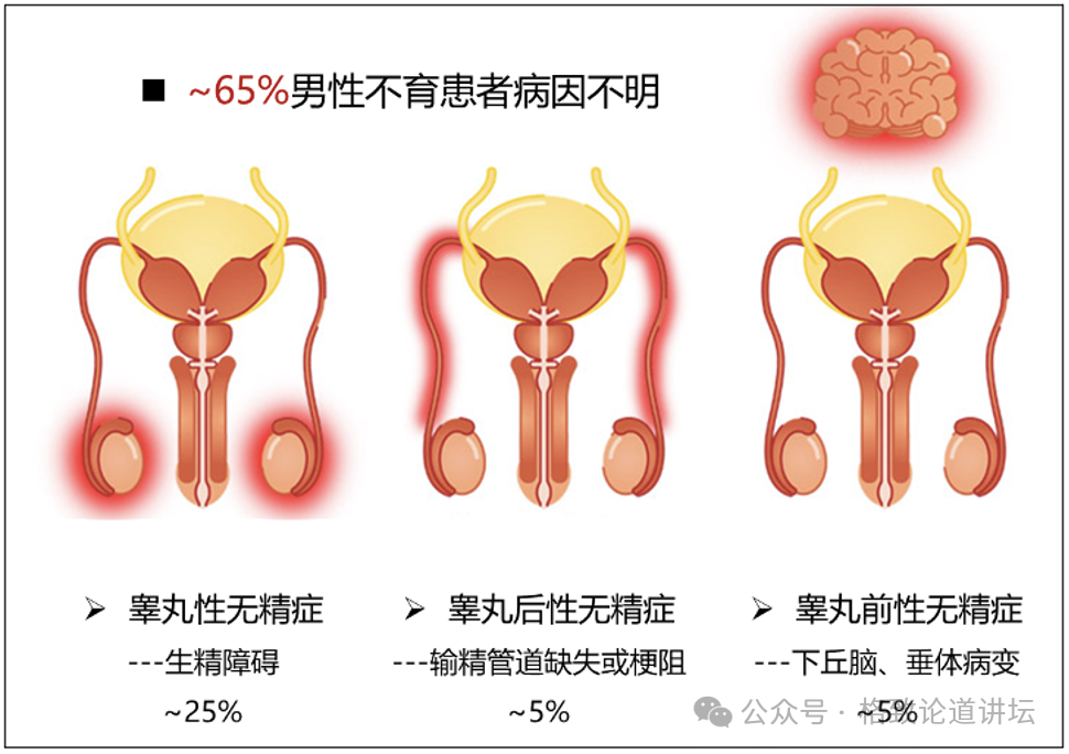 "深入剖析：不孕不育与性别角色认知的关联性<br>作为一名专业的网络，我深信一个事实：无论男女，任何可能导致不孕不育的原因都是复杂的，而女性在其中扮演着重要的角色。然而，对于许多男性来说，他们可能并没有充分理解女性不孕不育的问题。<br>据世界卫生组织的数据，全球有近2亿人处于不孕不育的状态。这是一个涉及生育能力的所有方面的问题，包括男性的生殖健康、精子质量、精子数量和活动力等。在女性方面，主要问题是排卵障碍和子宫内膜异位症。<br>这意味着，尽管男性和女性都可能存在某些原因导致不孕不育，但它们的根源往往取决于特定的性别角色刻板印象和缺乏对性功能健康的充分理解和认识。<br>因此，我们需要向所有男性传达这样一个信息：女性并非不孕不育的主要受害者，而是背后的重要支持者。女性可以贡献她们的劳动力、照顾子女以及照顾其他家庭成员的能力，这些都是男性无法或不愿意做到的。<br>让我们一起提高男性对女性不孕不育问题的认识，使我们更愿意采取积极的措施来解决这个问题。只有这样，我们才能真正实现性别平等，让每个生命都有其应有的价值。