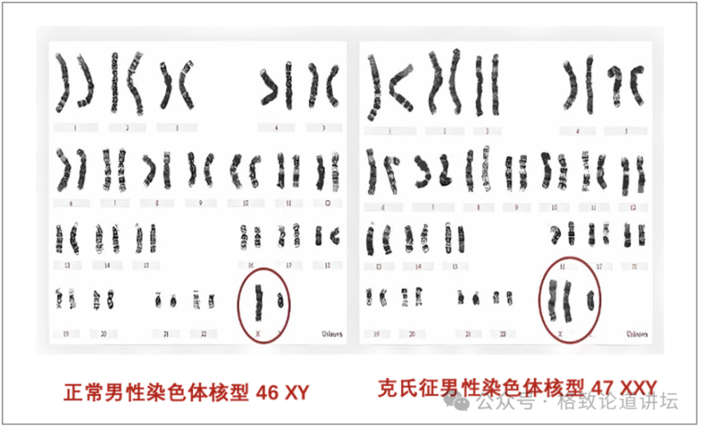 "深入剖析：不孕不育与性别角色认知的关联性<br>作为一名专业的网络，我深信一个事实：无论男女，任何可能导致不孕不育的原因都是复杂的，而女性在其中扮演着重要的角色。然而，对于许多男性来说，他们可能并没有充分理解女性不孕不育的问题。<br>据世界卫生组织的数据，全球有近2亿人处于不孕不育的状态。这是一个涉及生育能力的所有方面的问题，包括男性的生殖健康、精子质量、精子数量和活动力等。在女性方面，主要问题是排卵障碍和子宫内膜异位症。<br>这意味着，尽管男性和女性都可能存在某些原因导致不孕不育，但它们的根源往往取决于特定的性别角色刻板印象和缺乏对性功能健康的充分理解和认识。<br>因此，我们需要向所有男性传达这样一个信息：女性并非不孕不育的主要受害者，而是背后的重要支持者。女性可以贡献她们的劳动力、照顾子女以及照顾其他家庭成员的能力，这些都是男性无法或不愿意做到的。<br>让我们一起提高男性对女性不孕不育问题的认识，使我们更愿意采取积极的措施来解决这个问题。只有这样，我们才能真正实现性别平等，让每个生命都有其应有的价值。