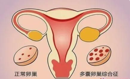 "精准解读：避孕药的神奇奥秘与应用价值"