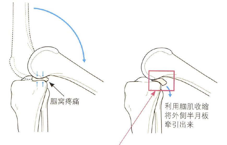 "深入了解膝盖不适：小肌肉的奥秘与应对方法"