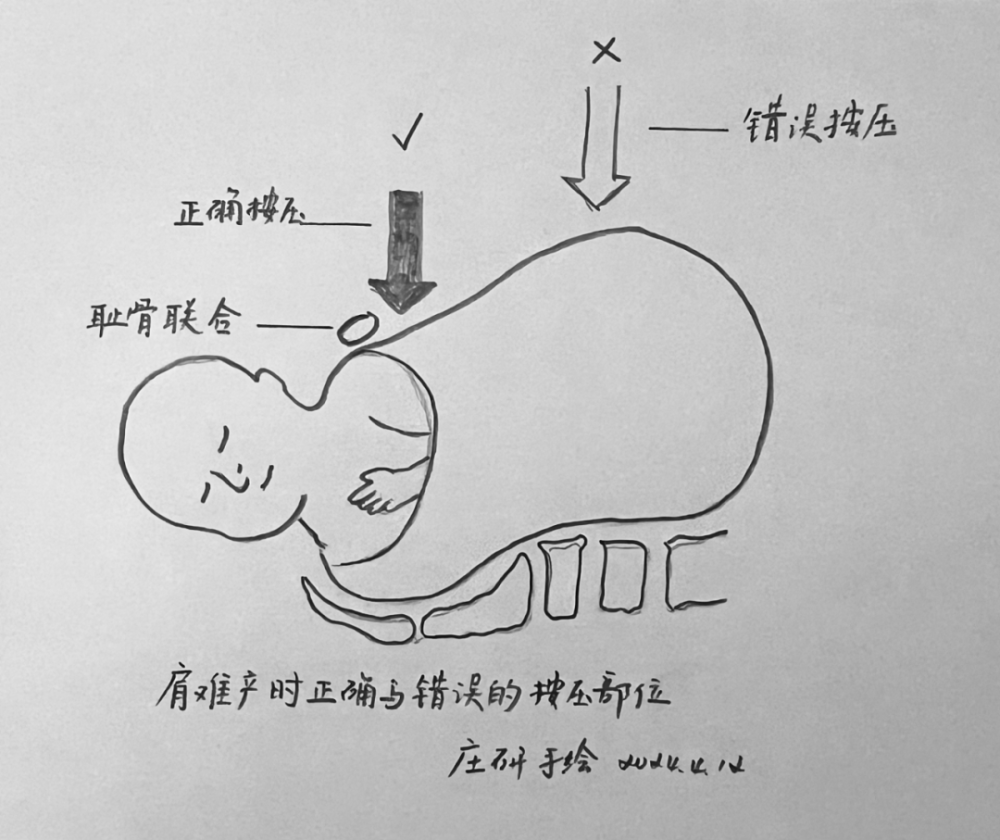 "身患疾病痛苦分娩：专家指导如何应对艰巨的挑战"