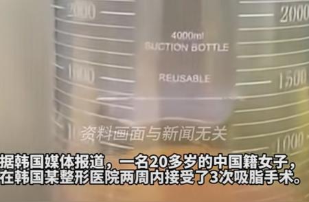 中国籍女子在韩抽脂手术后死亡、