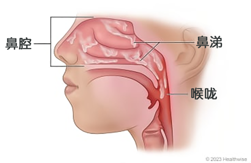 "小孩喉咙不适应如何快速缓解并恢复健康？"