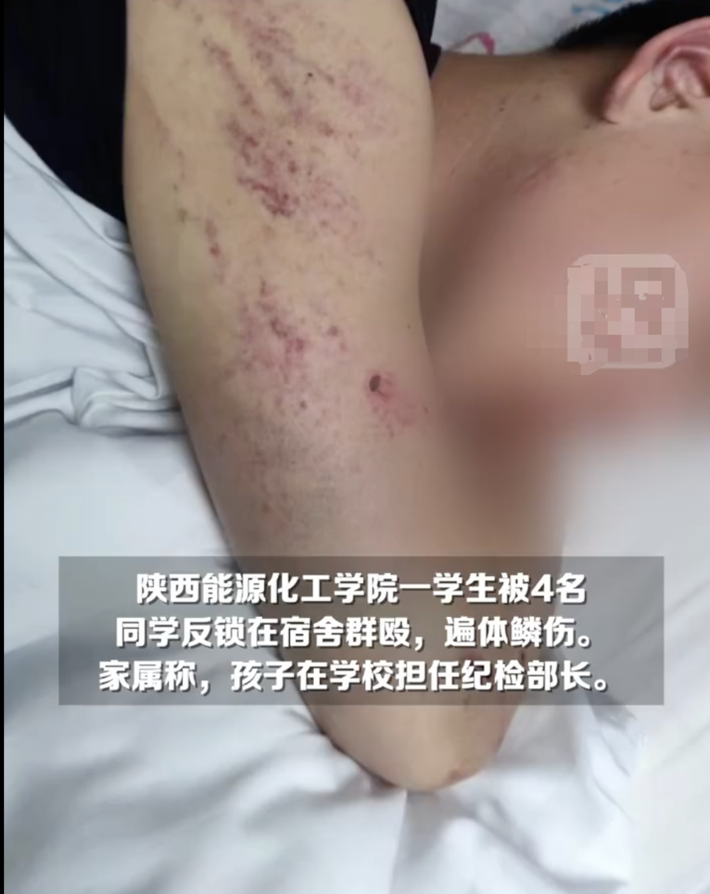 "职校男生遭群殴事件，4名学生被刑拘；家长疑与管理手机有关，称孩子需自行控制上网时间"