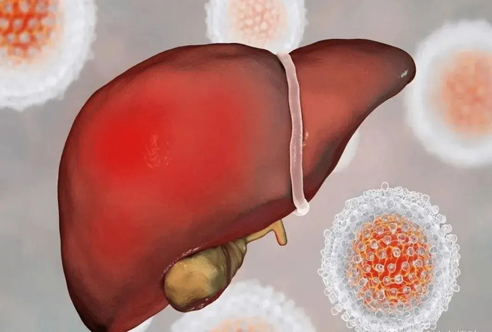 "预防肝癌的五大关键：5个高风险因素和9项必备措施"