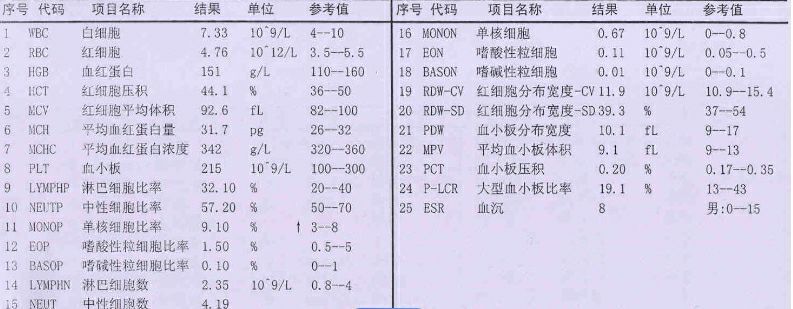 "检查血糖是否正常：警惕肝硬化与脾大的信号！"