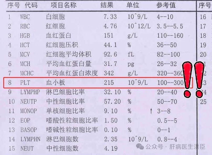 "检查血糖是否正常：警惕肝硬化与脾大的信号！"